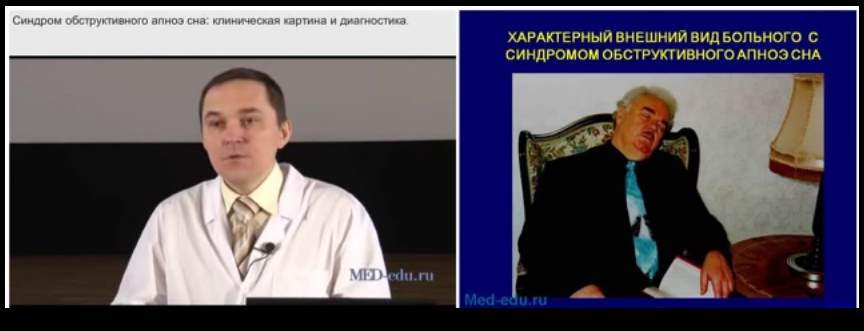 АПНОЭ сна.jpg